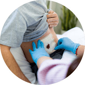woundcare follow up wound care followup